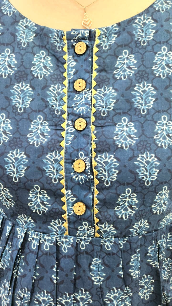 Blue and White Block print Feeding Kurti